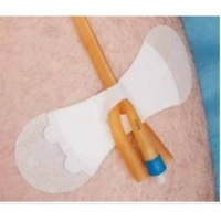 Baxter #3400LFC, CATHETER, LRG, FOLEY, STABALIZATION DEVICE, 100/CS Image Baxter #3400LFC, CATHETER, LRG, FOLEY, STABALIZATION DEVICE, 100/CS Image