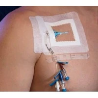 Centurion #SV40XT, DRESSING, IV, TRANSP, 4"X4.75", SORBAVIEW L, EACH Image Centurion #SV40XT, DRESSING, IV, TRANSP, 4"X4.75", SORBAVIEW L, EACH Image