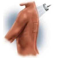 MPM Medical #MP00082, Dressing Repel 4x4" Composite Absorbent Non Adherent 30/Bg Image MPM Medical #MP00082, Dressing Repel 4x4" Composite Absorbent Non Adherent 30/Bg Image