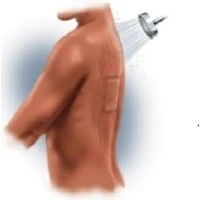 MPM Medical #MP00086, Dressing Repel 6x8" Composite Absorbent Non Adherent 30/Bg Image MPM Medical #MP00086, Dressing Repel 6x8" Composite Absorbent Non Adherent 30/Bg Image