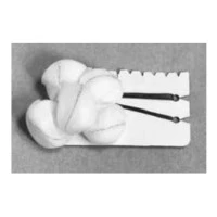 Teleflex #200333, SPONGE, TONSIL, MEDIUM, GAUZE, STERILE, 500/CS Image Teleflex #200333, SPONGE, TONSIL, MEDIUM, GAUZE, STERILE, 500/CS Image