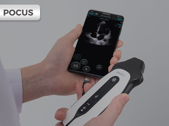 pocus innov.jpg