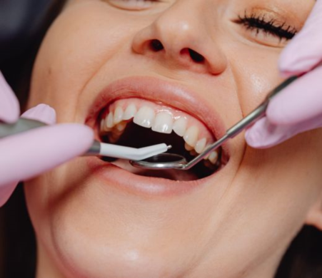 The Best Options for Affordable Cosmetic Dentistry Treatments