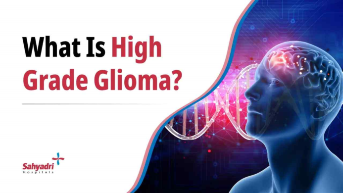 High-Grade Glioma: Symptoms, Diagnosis, Treatment and Beyond