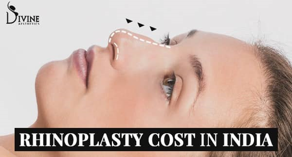 What Is Rhinoplasty? and Cost