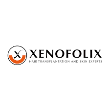 Xenofolix: The Best Hair Transplant Clinic in Kochi.