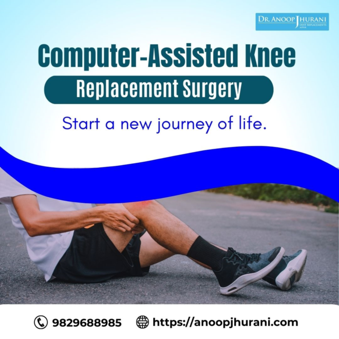Navigating Joint Replacement: The Power of Computer-Assisted Technology
