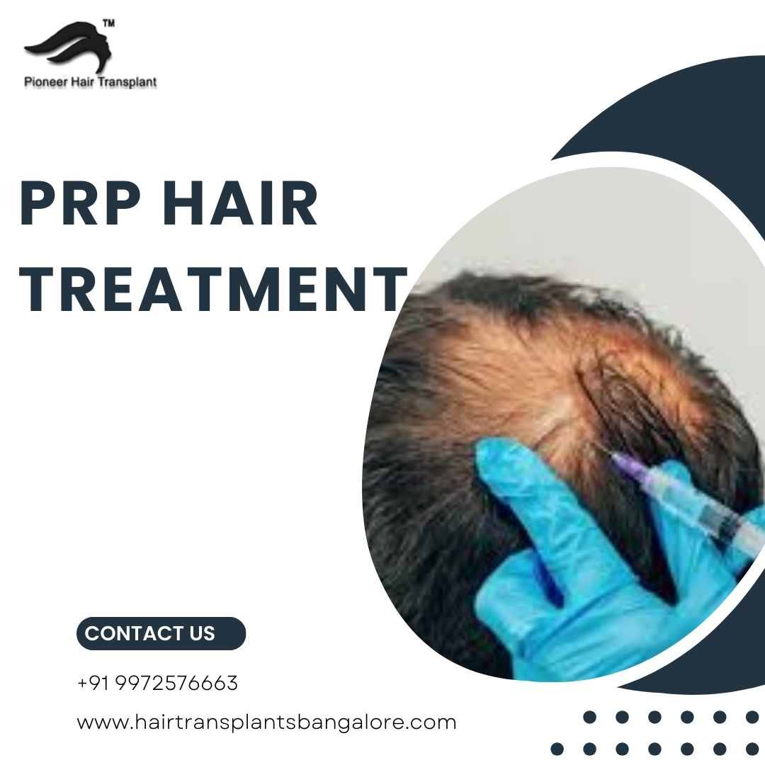 PRP Treatment Cost in Bangalore PRP Hair Treatment