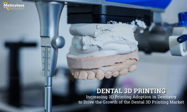 Dental 3D Printing Market to be Worth $13.4 Billion by 2030