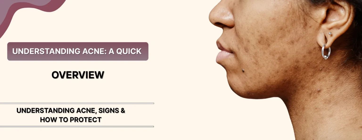 Can Acne Be Triggered by Long Screen Time & Blue Light?