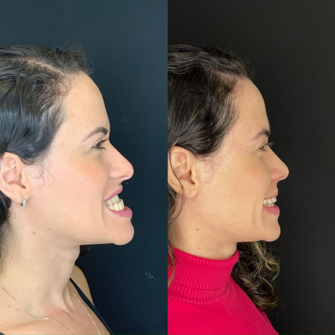 Drº Israel Vicente: Transformando Vidas Através da Cirurgia Ortognática