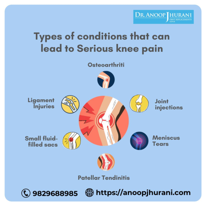 Types of conditions that can lead to Serious knee pain