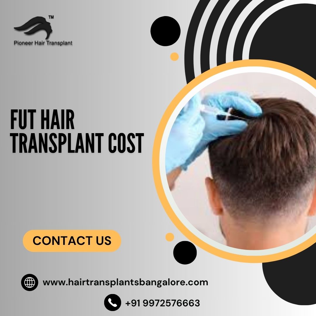 Best FUE Hair Transplant in Bangalore 