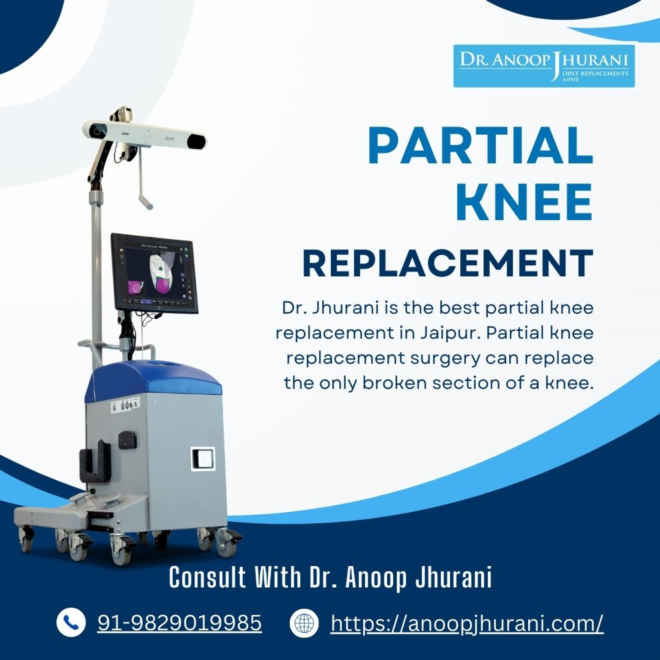 Precision and Comfort: Robotic Partial Knee Replacement 