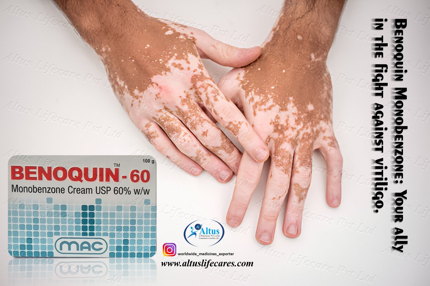 A Comprehensive Guide to Benoquin 60 CREAM