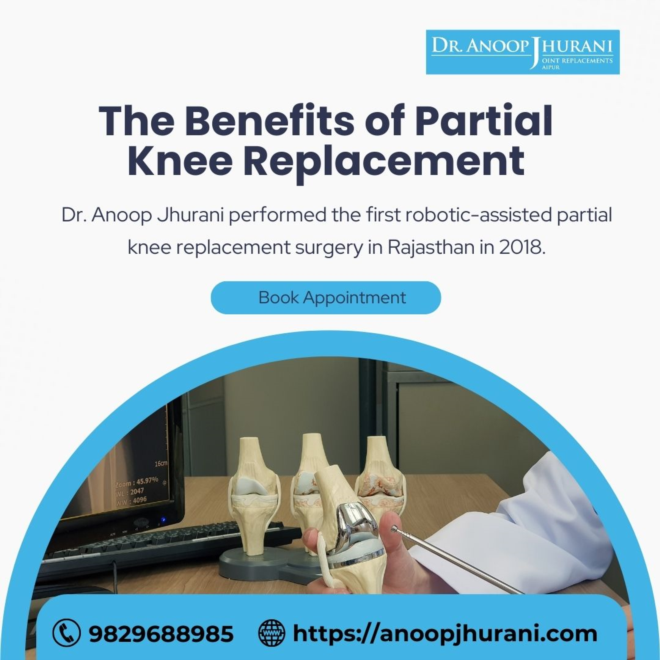 The Benefits of Partial Knee Replacement 