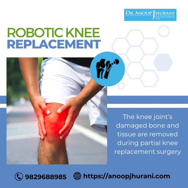 Advantages of Partial Knee and Ligament-Preserving Knee Replacement