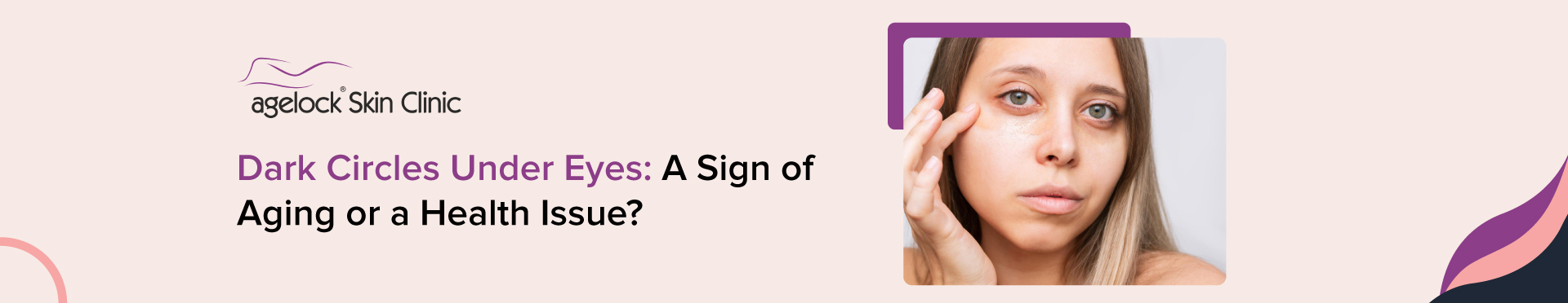 Dark Circles Under Eyes: A Sign Of Aging Or A Health Issue?