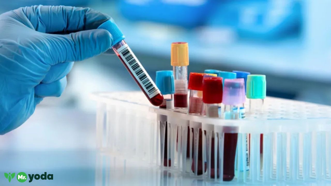 Diagnostics in Hyderabad Early and Accurate Healthcare