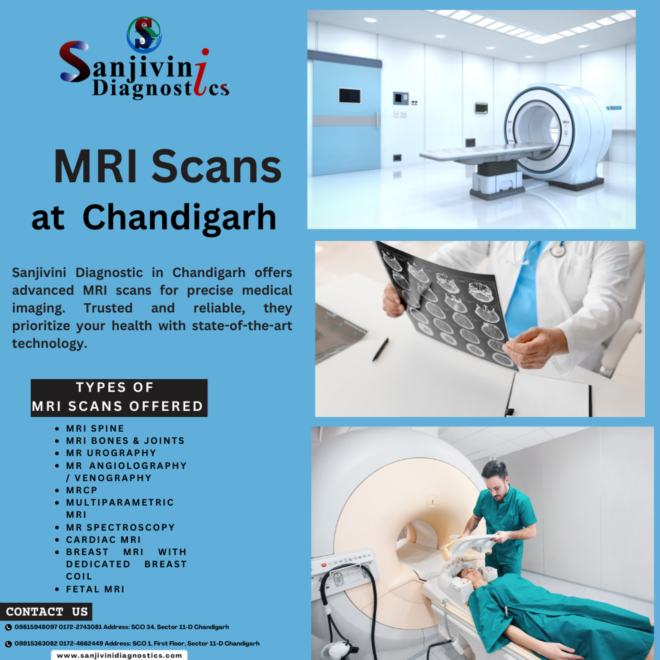 Affordable Price MRI Scan  in Chandigarh  -sanjivinidiagnostics