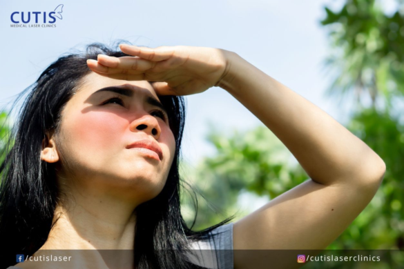 What Age Does Sun Damage Start to Show?