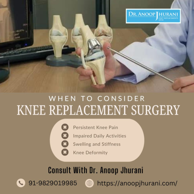 When to Consider Knee Replacement Surgery