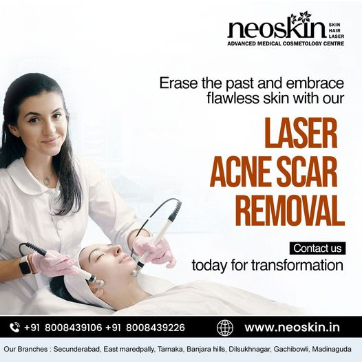 Scar removal treatment in Hyderabad | Neoskin Clinic