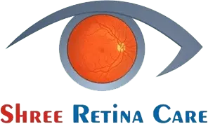 What Causes Black Spots on the Eyeball?