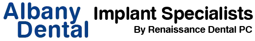 All On 4 Implants Albany
