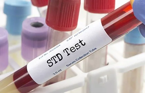 STD testing singapore