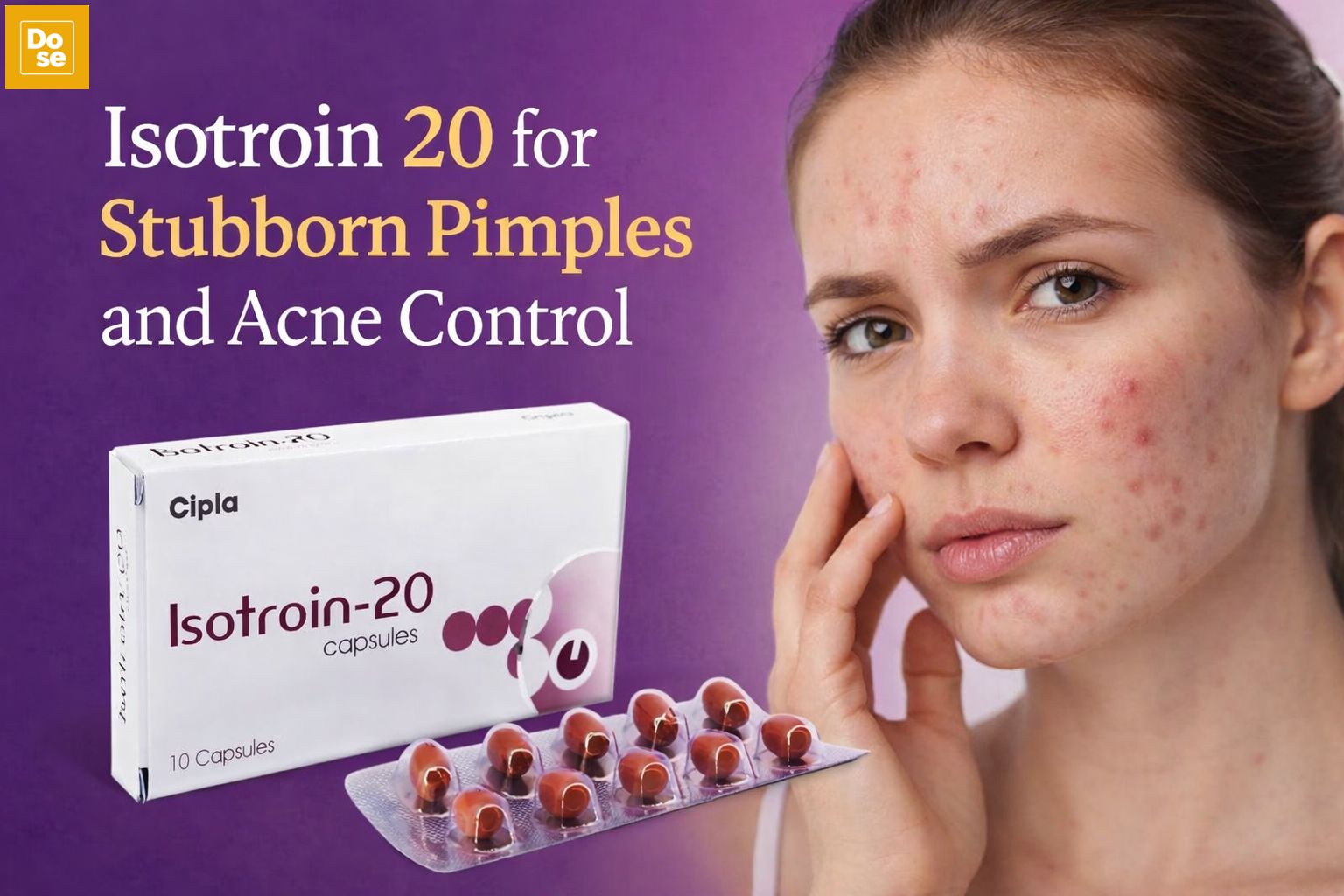 Isotroin 20 for Stubborn Pimples and Acne Control