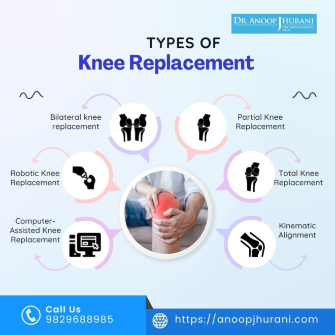 Revolutionizing Knee Replacement Surgery