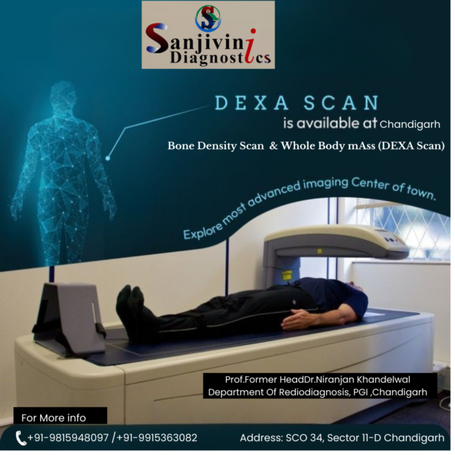 Comprehensive Dexa Scan Services in Chandigarh: Choose Sanjivini Diagnostics for Precise Results