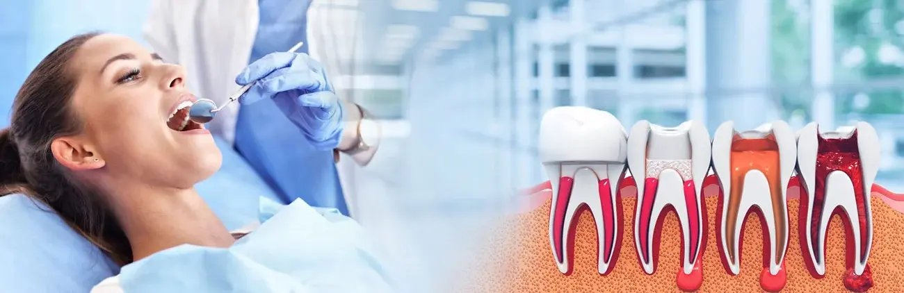 Root canal treatment cost in Ahmedabad (2026 updated guide)