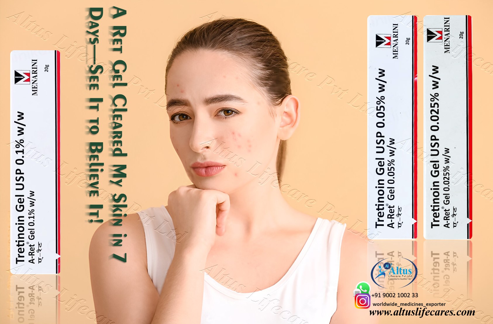 A Ret Gel 0.1% Before and After Photos