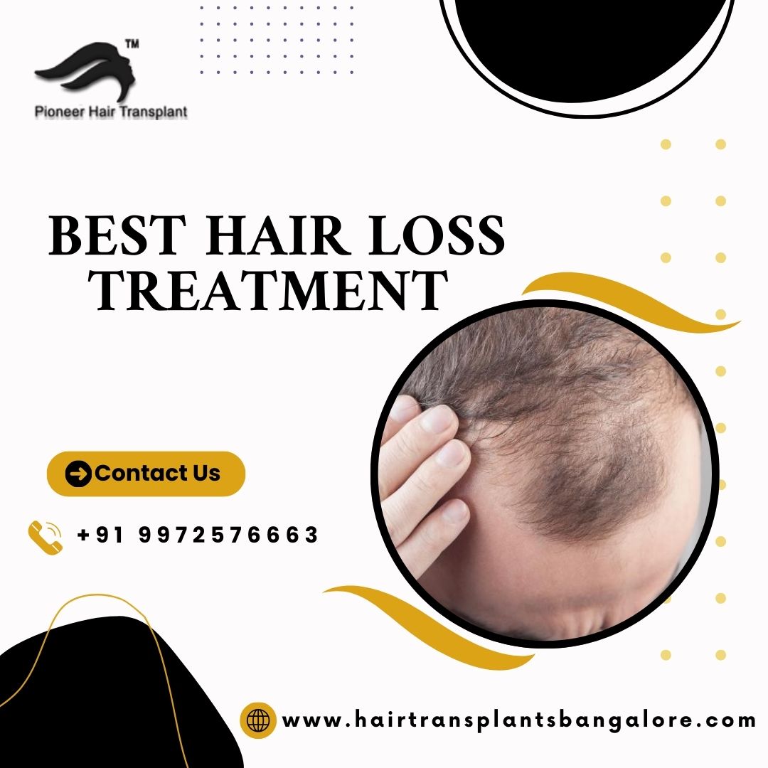 Best Hair Loss Treatment in Bangalore