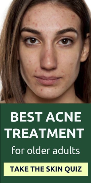 Comprehensive Medical Treatment for Severe Acne