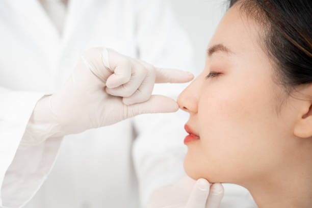 Rhinoplasty Explained for Facial Harmony and Confidence
