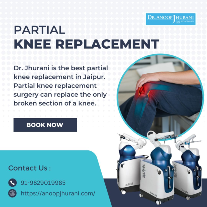 Step into Comfort with Robotic Knee Replacement 