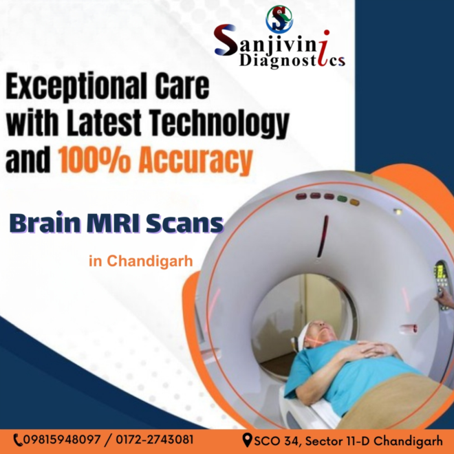 "State-of-the-Art Brain Imaging: Sanjivini Diagnostics in Chandigarh"
