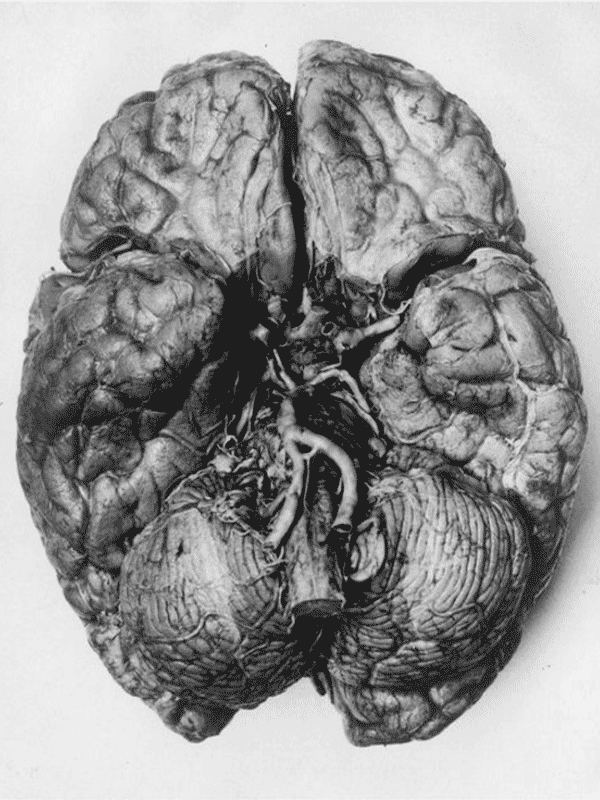 Inferior view of human brain with visible arteries for Other e-reader wallpaper or screensaver featuring brain and anatomy and more