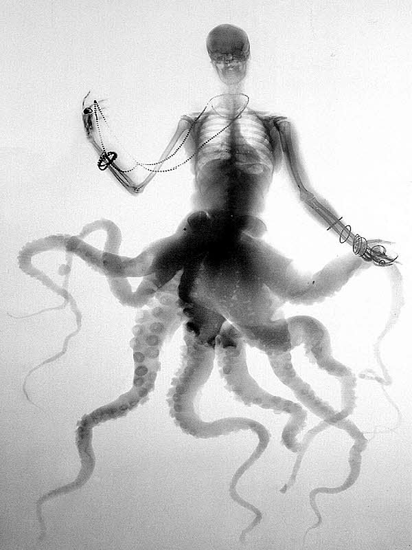 X-ray of a skeleton with an octopus for Other e-reader wallpaper or screensaver featuring x-ray and skeleton and more