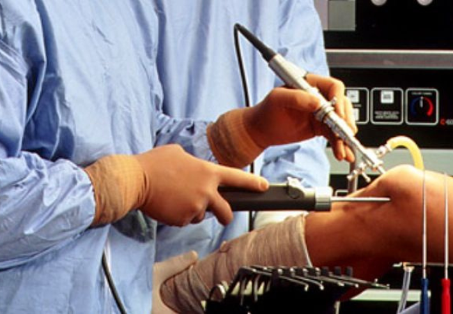 Top Signs You Might Need a Joint Replacement