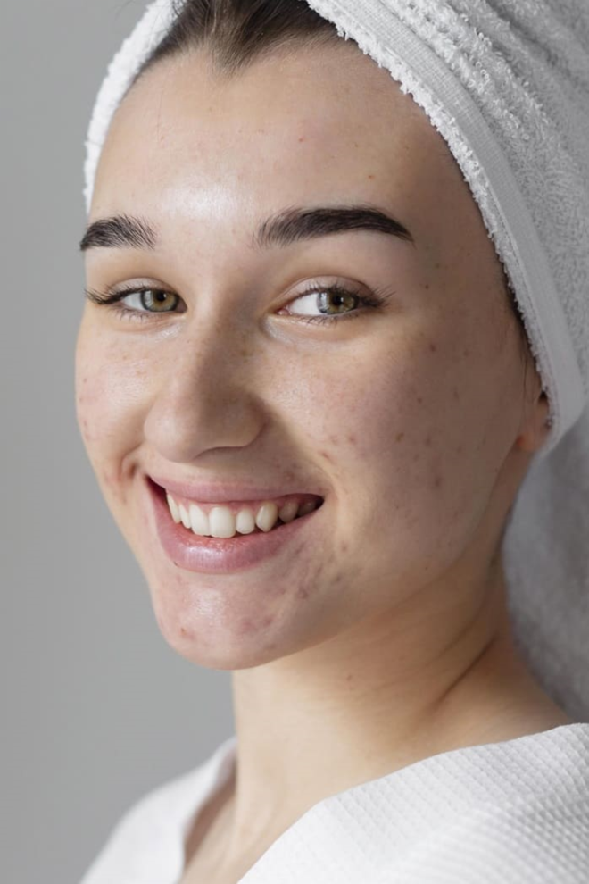 Advanced Pimple Treatments for Clear Skin