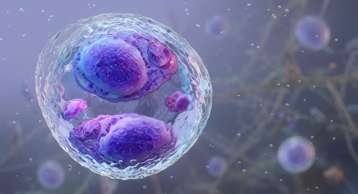 Cyclospora cases top 17,000 as feds cut parasite research
