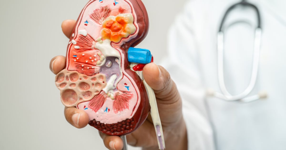 Investigación revela vínculo crítico entre enfermedad renal y cardíaca